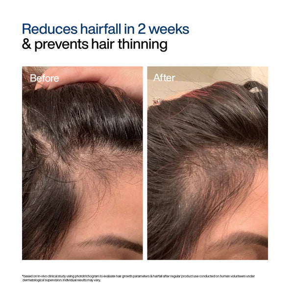 WishCare Hair Growth Serum Concentrate 30ml