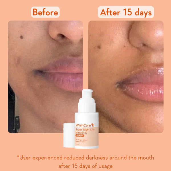 WishCare Super Bright Vitamin C16 Serum 30ml
