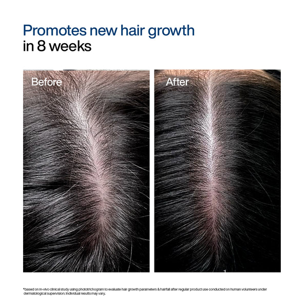WishCare Hair Growth Serum Concentrate Roll On