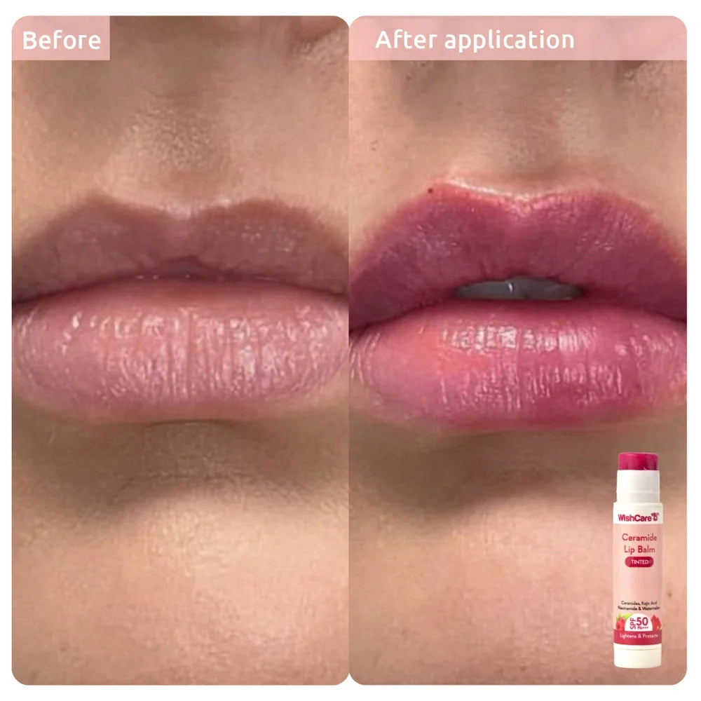 WishCare Sun &amp; Lip Care Combo