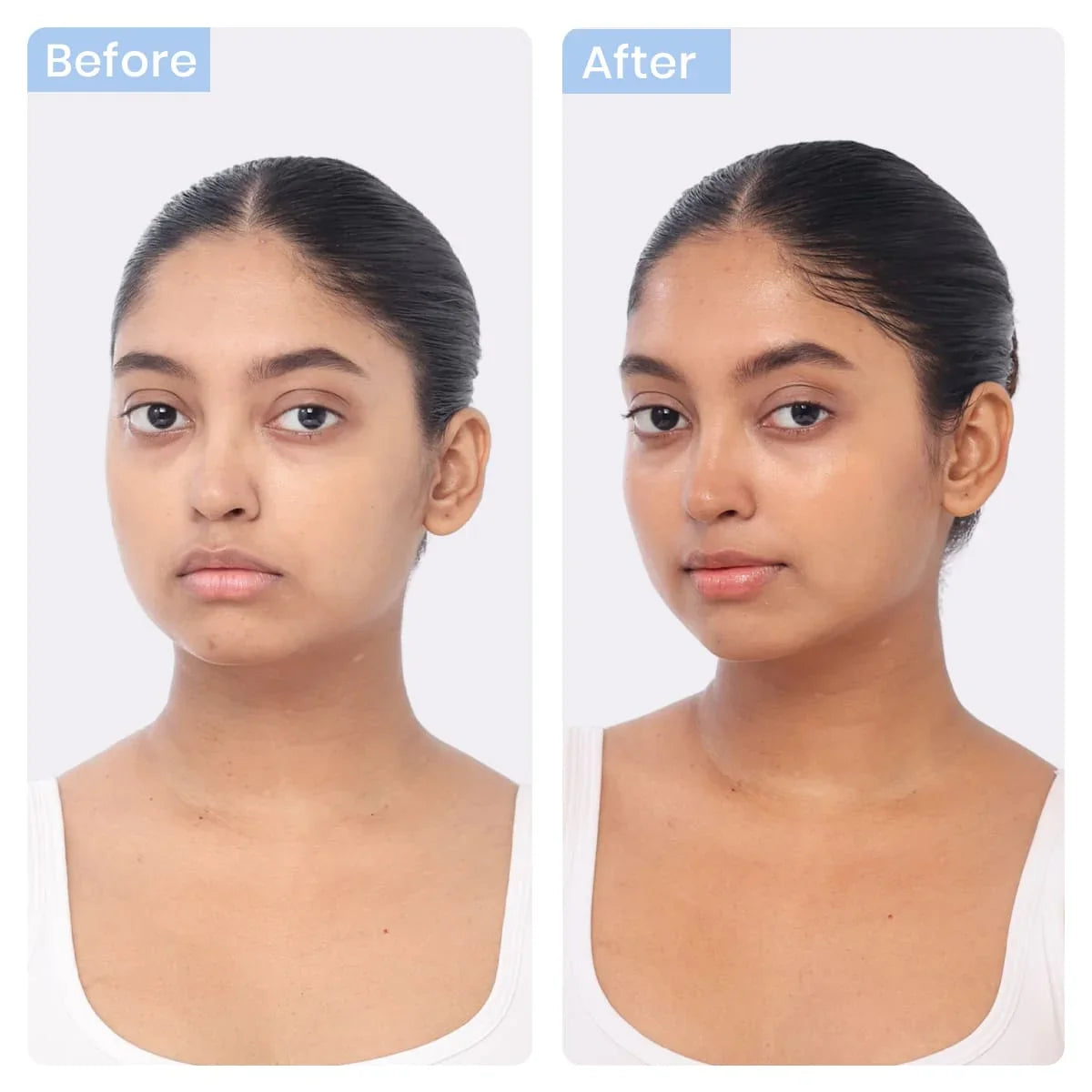 WishCare 2:1:3 NMF Water Gel Moisturizer – Oil-Free Hydrating Face Moisturizer 50g