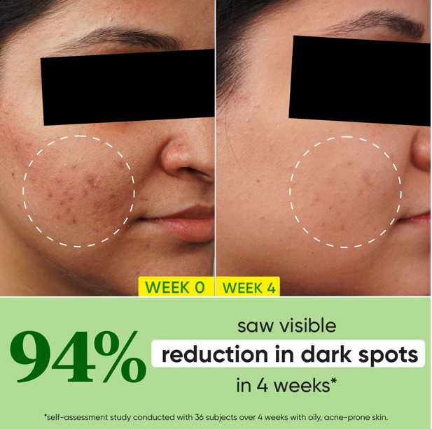 Dot & Key Cica + 10% Niacinamide Spot Reduction Face Serum 30ml