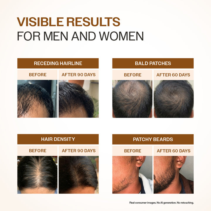 Bare Anatomy Advanced Hair Growth Serum | 30ml