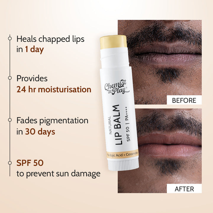 Chemist at Play Natural Lip Balm SPF 50 PA++++ | 1% Kojic Acid & Ceramides | 4.5g