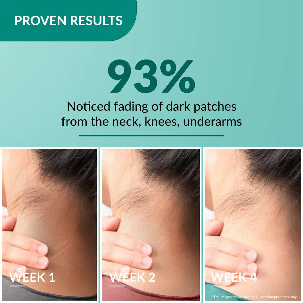 Fixderma Nigrifix Cream