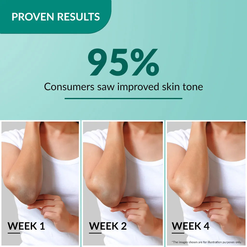 Fixderma Nigrifix Cream