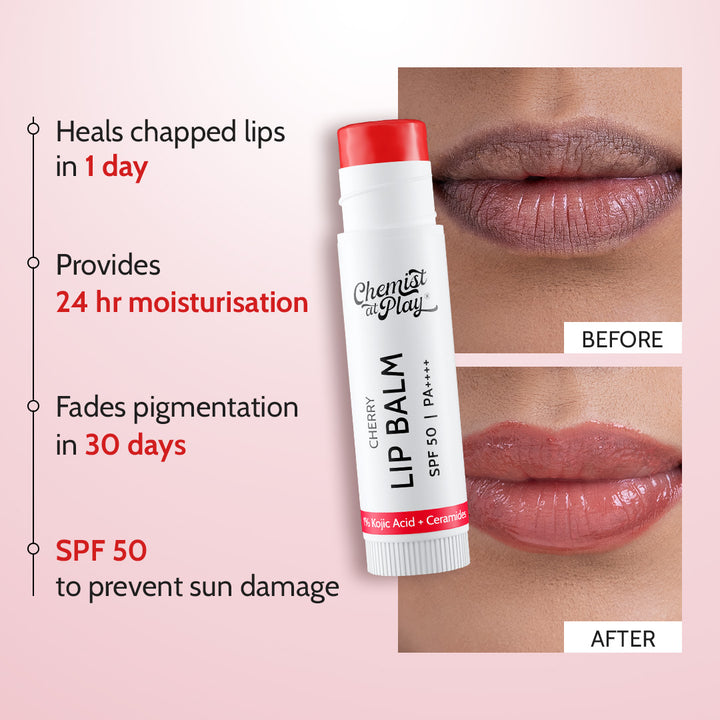 Chemist at Play Cherry Lip Balm SPF 50 PA++++ | 1% Kojic Acid & Ceramides | 4.5g