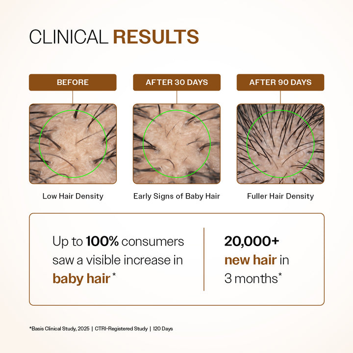 Bare Anatomy Advanced Hair Growth Serum | 30ml